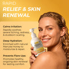Psoriasis Big Lotion