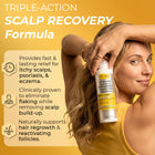 Psoriasis Shampoo