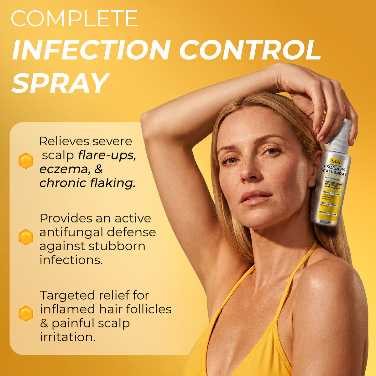 Psoriasis Scalp Spray