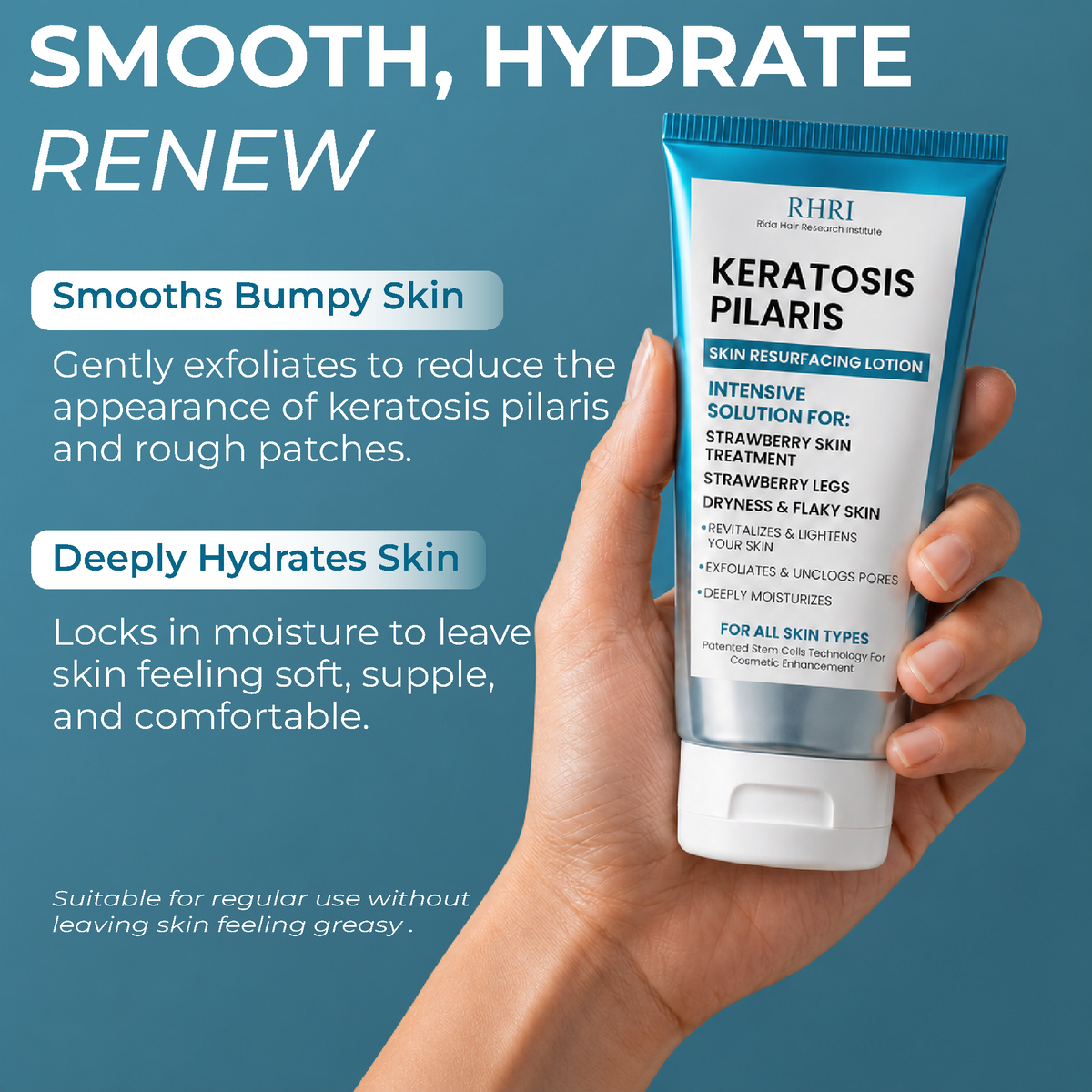 KP  Lotion
