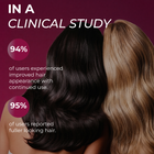 Minoxidil for Women Foams