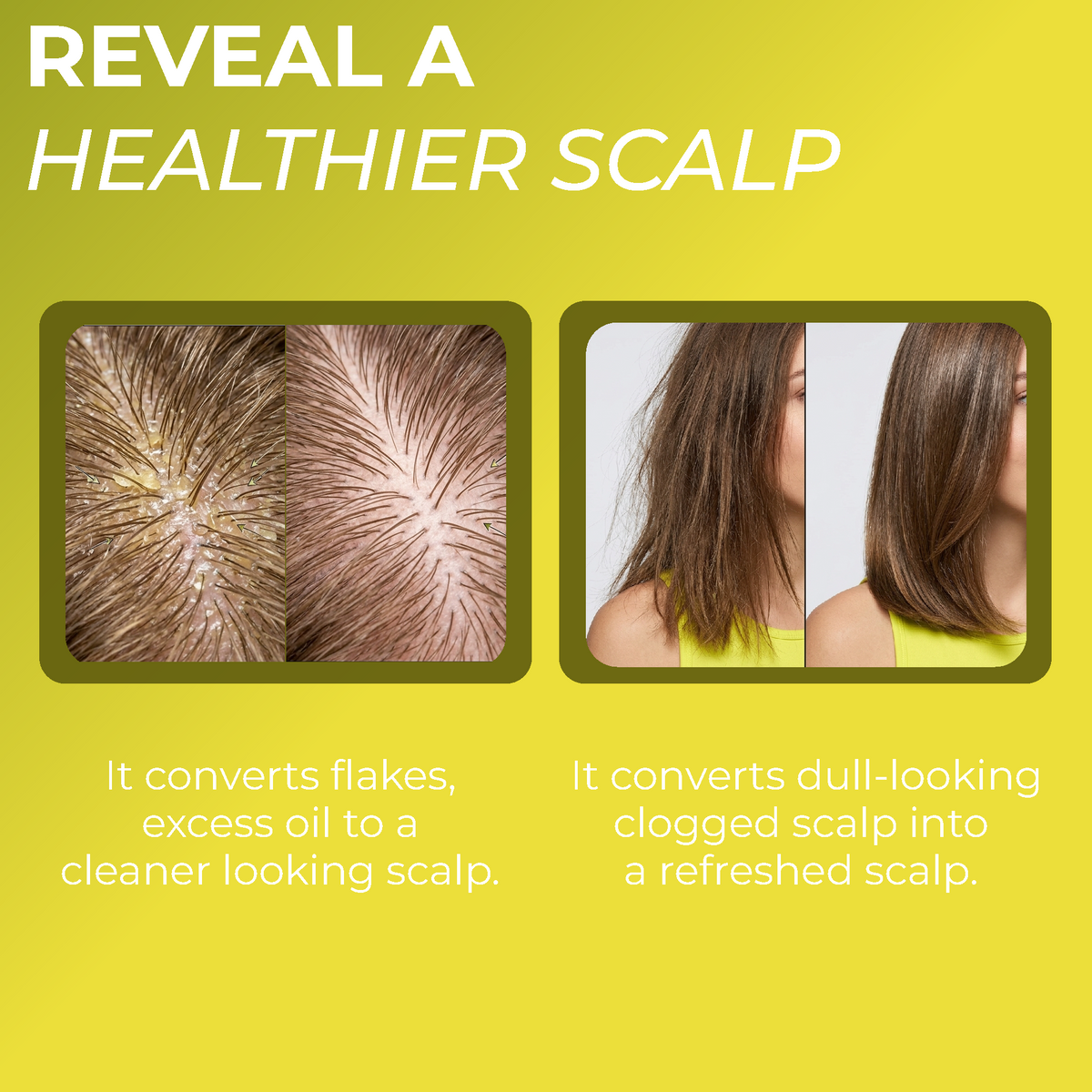 Folliculitis Scalp Scrub
