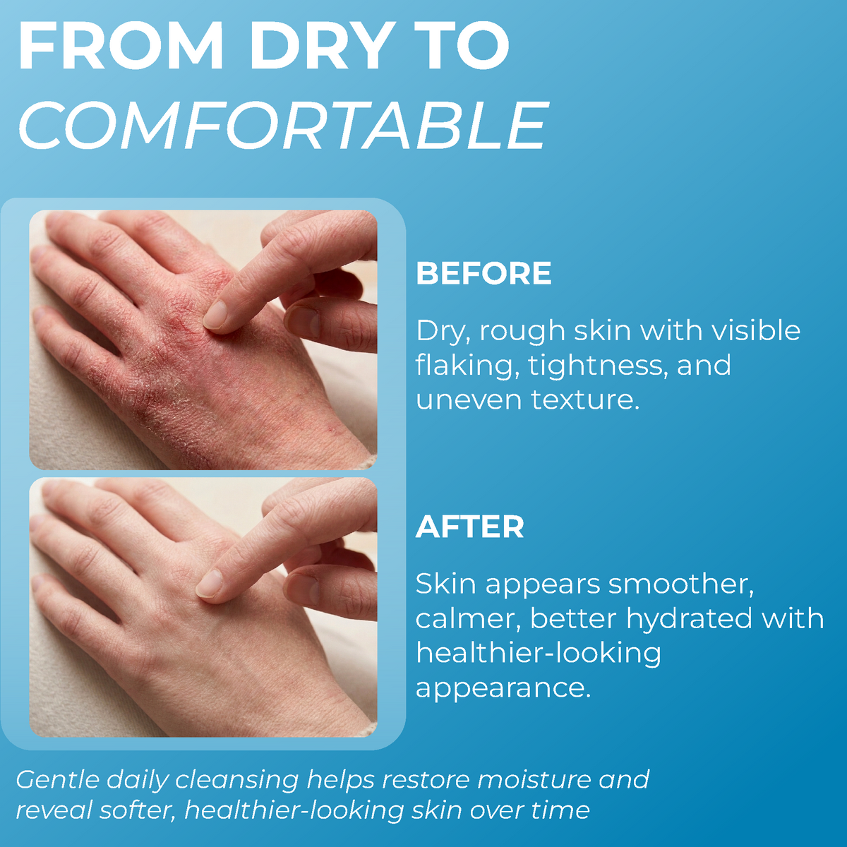 Eczema body wash foam