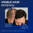 5% minoxidil for Men Spray Pack of 2