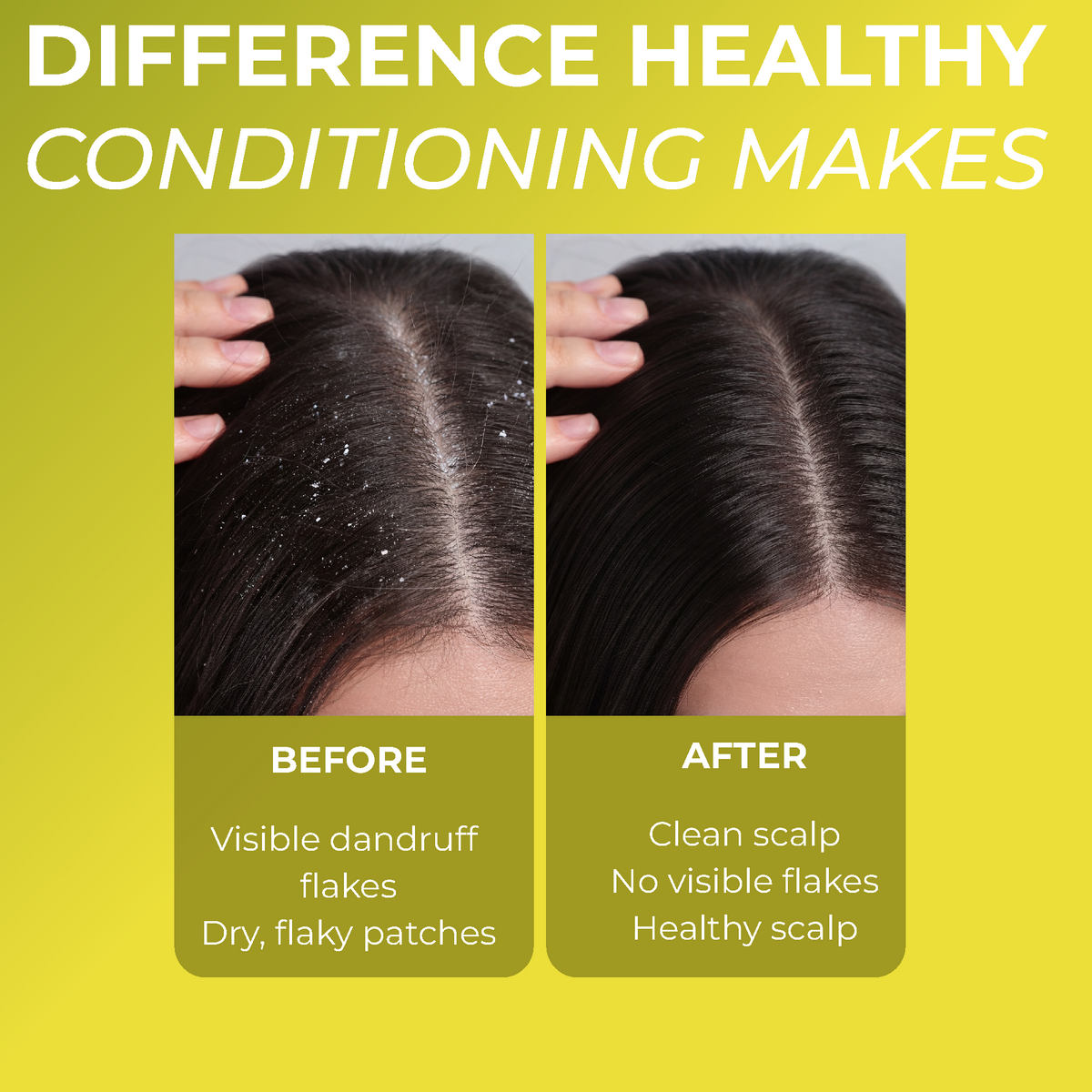 Folliculitis  Conditioner