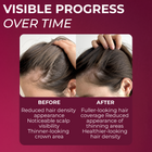 2% minoxidil for Women Spray Pack of 2