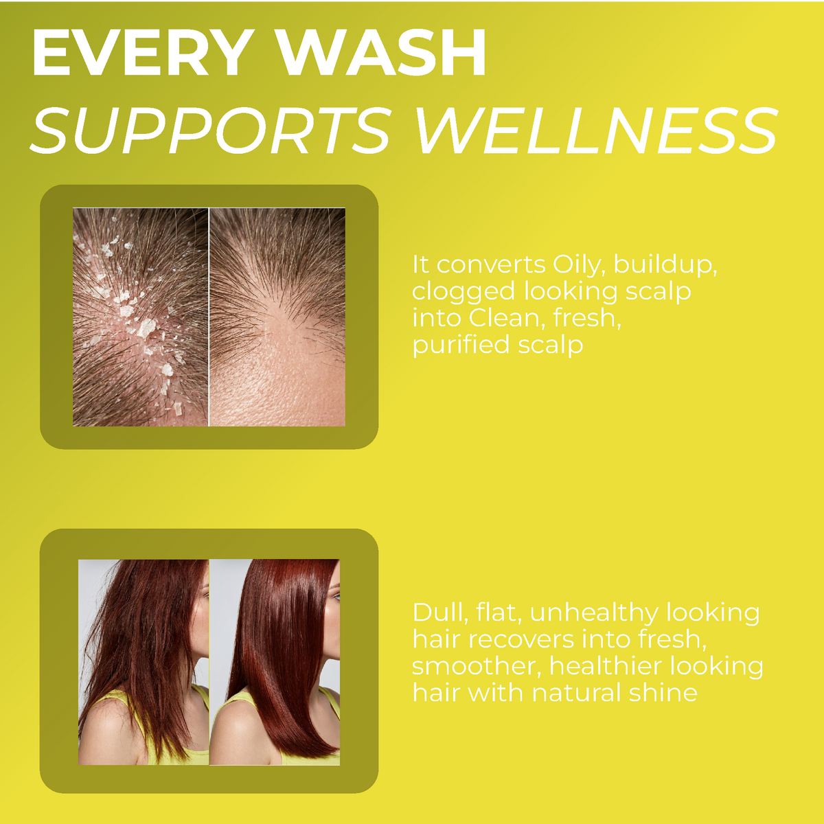 Folliculitis Shampoo Refill