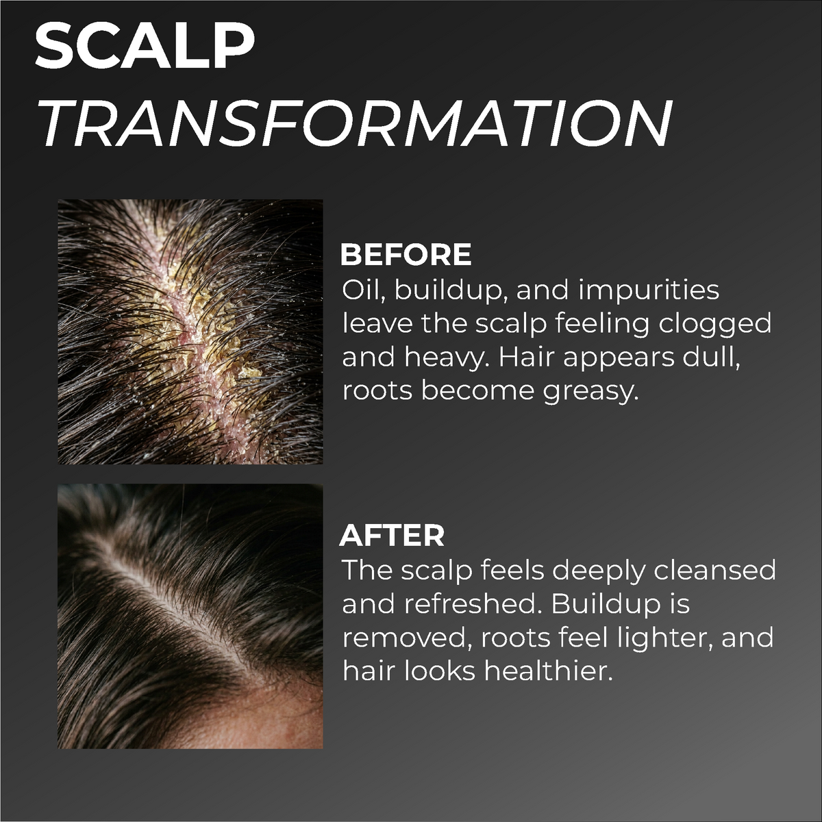 Charcoal Scalp Scrub
