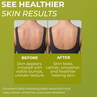 Folliculitis body wash foam