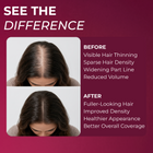 Minoxidil for Women Foams