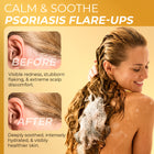 Psoriasis Conditioner