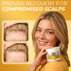 Psoriasis Scalp scrub