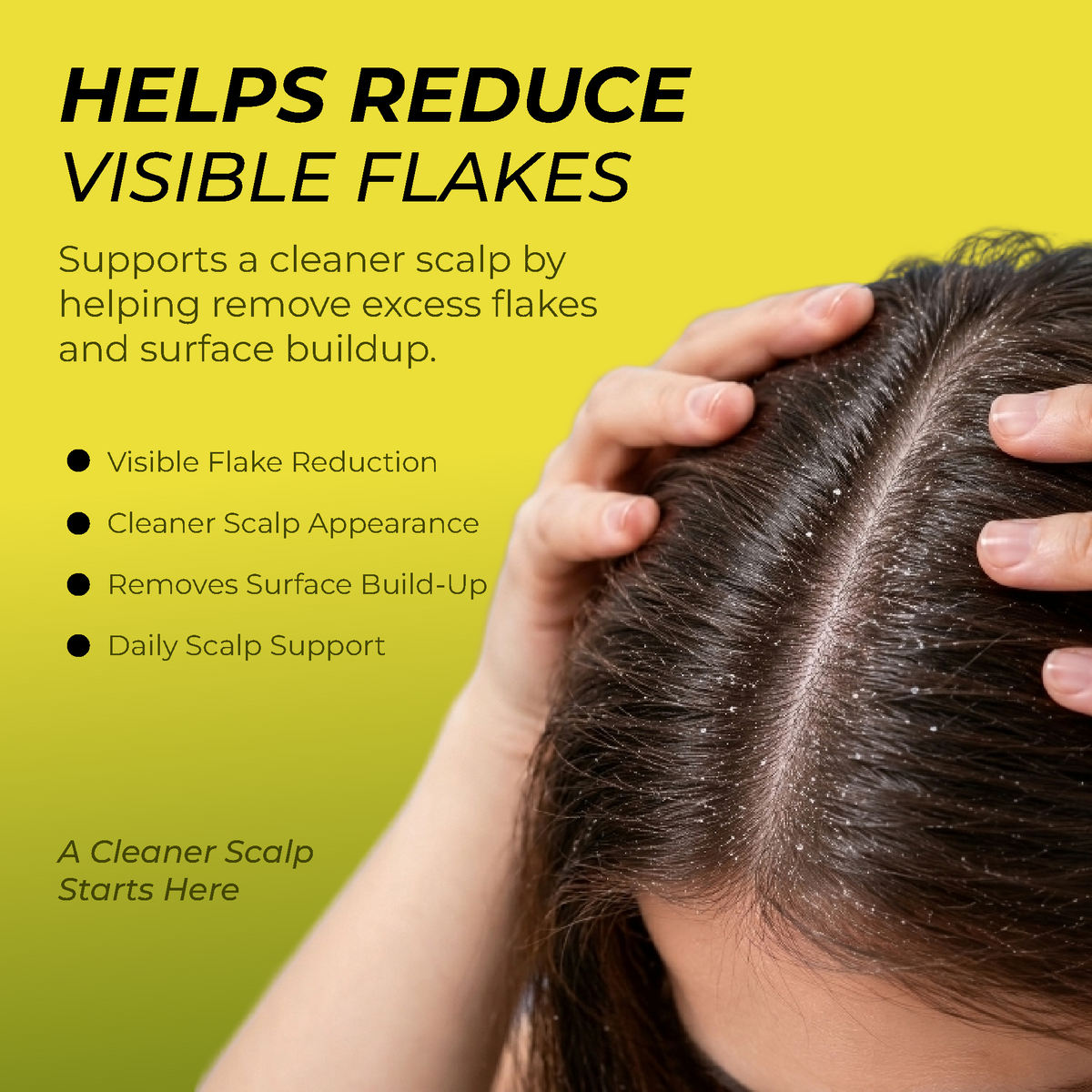Folliculitis Shampoo