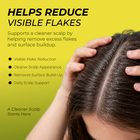 Folliculitis Shampoo