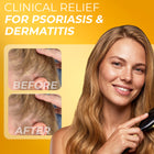 Psoriasis Shampoo refill