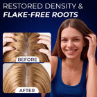 Anti Dandruff Scalp Scrub
