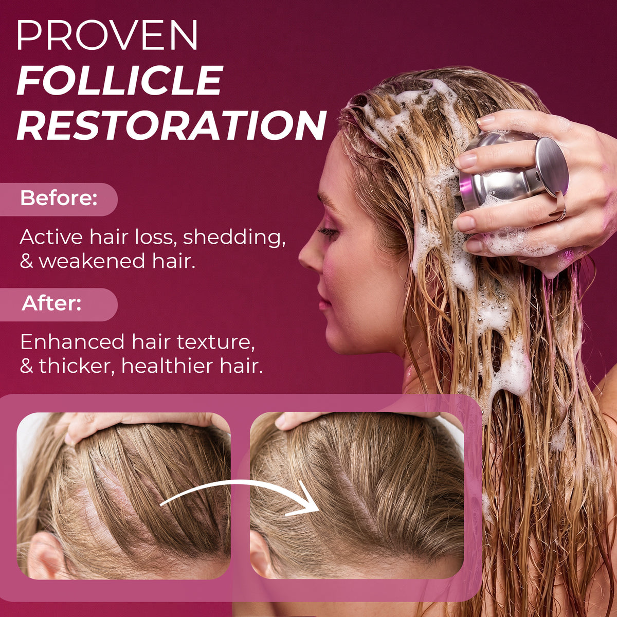 Hair Growth SC Set Women
