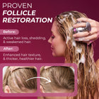 Hair Growth SC Set Women