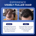Hair Growth Vitamins Men