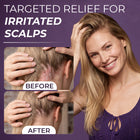 Neoketramin Scalp Spray