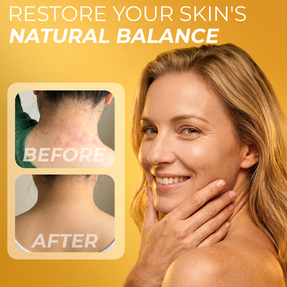 Psoriasis body wash Gel