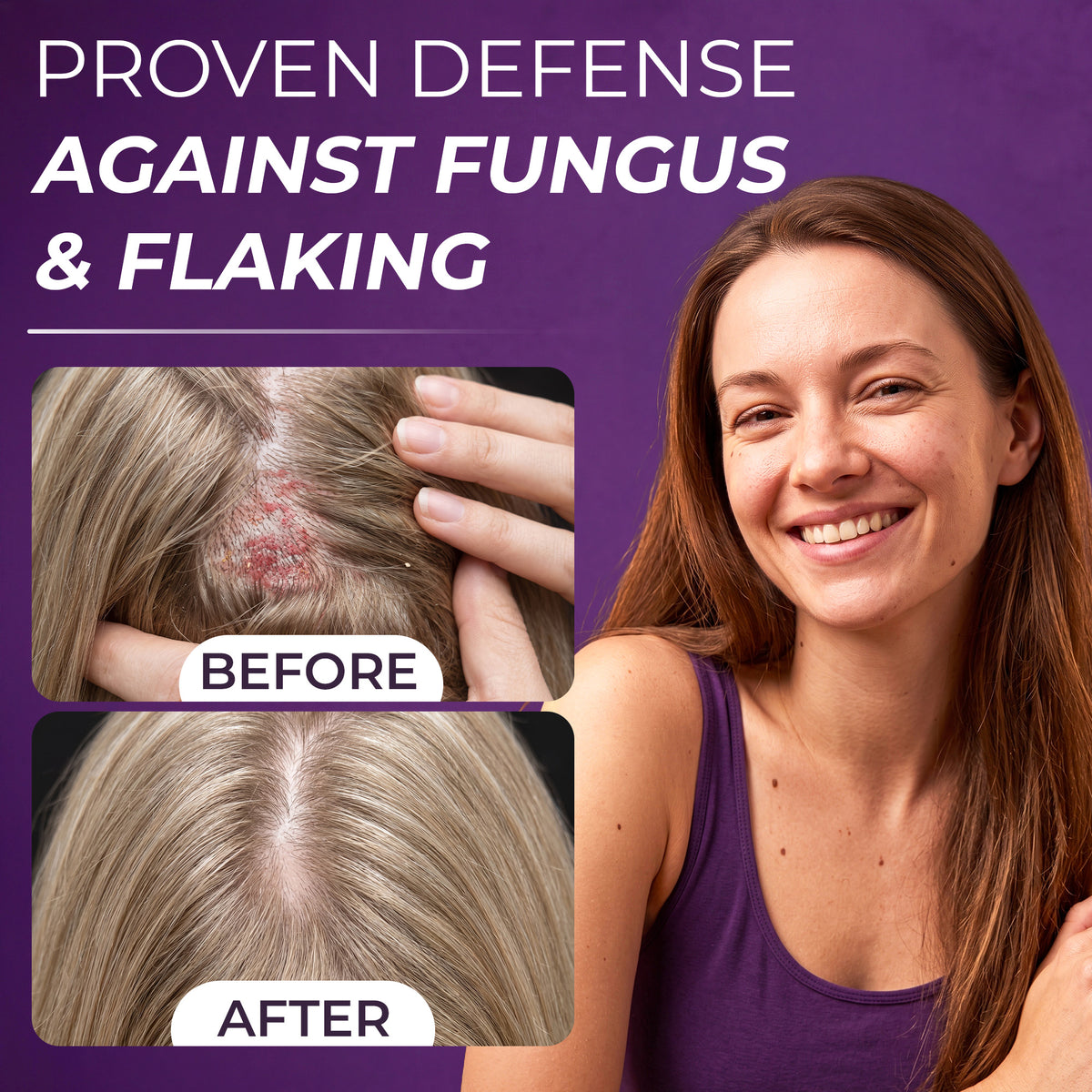 Neoketramin Scalp Scrub