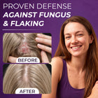 Neoketramin Scalp Scrub