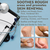 Callus Remover for Feet