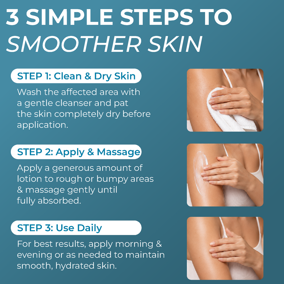 KP  Lotion